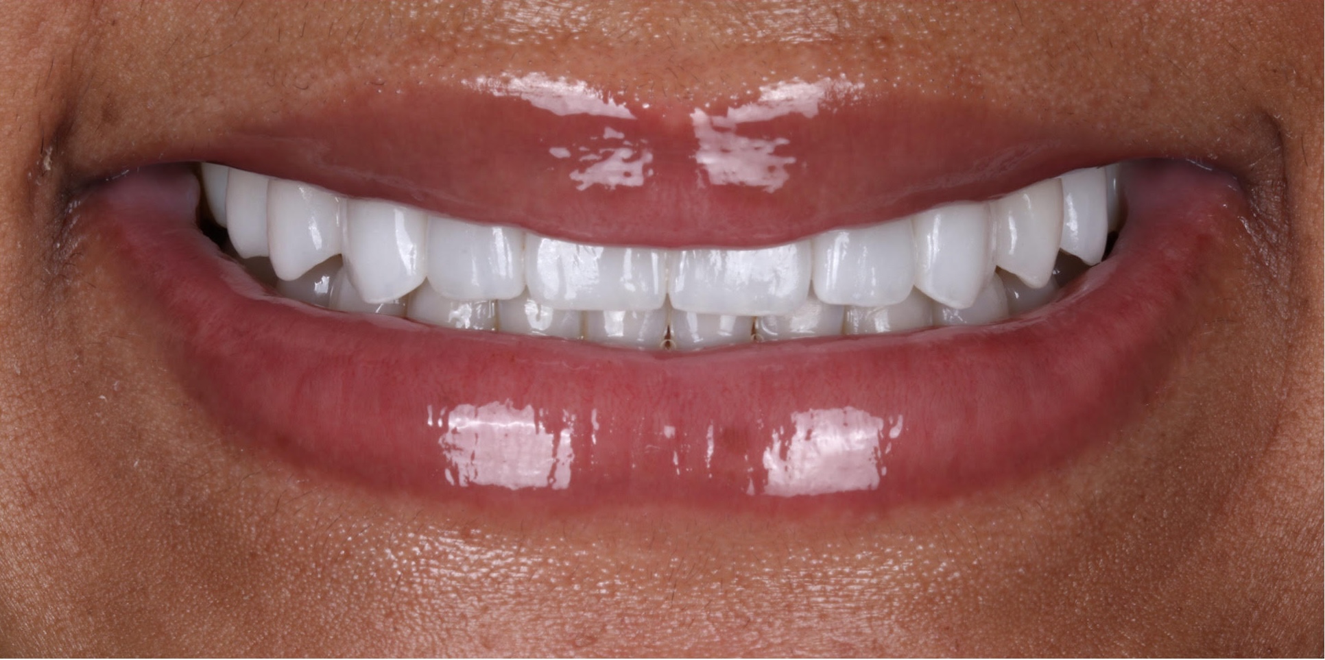 After dental treatment
