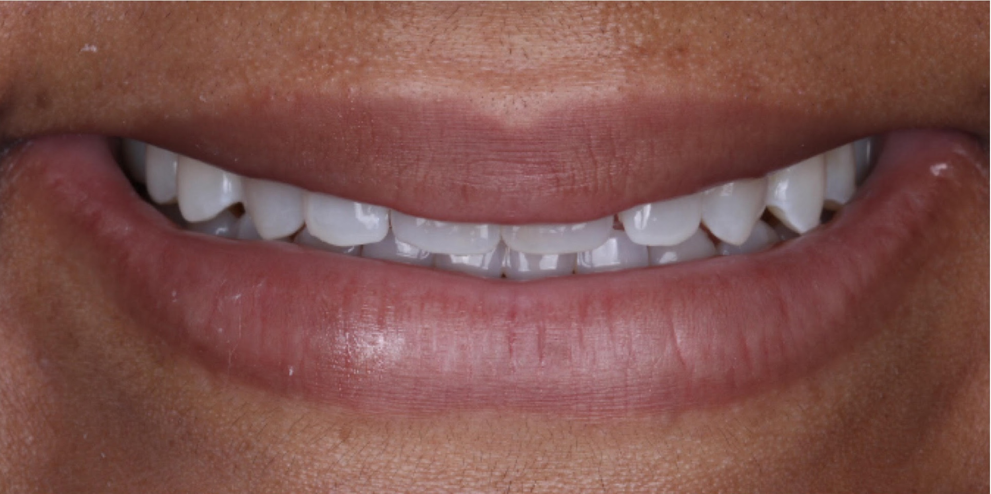 Before dental treatment